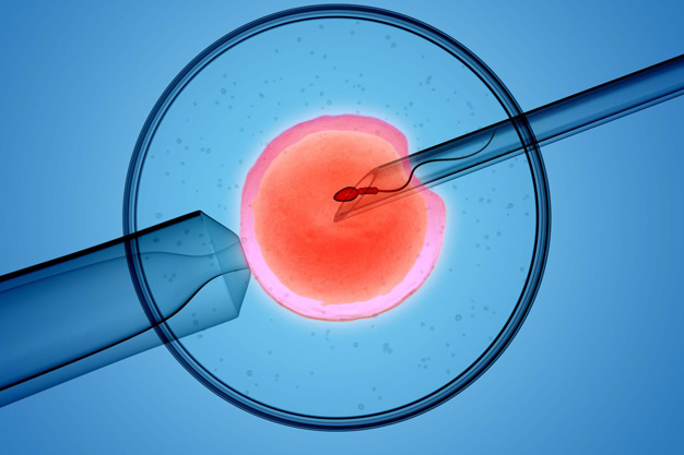 Intruterine Insemination